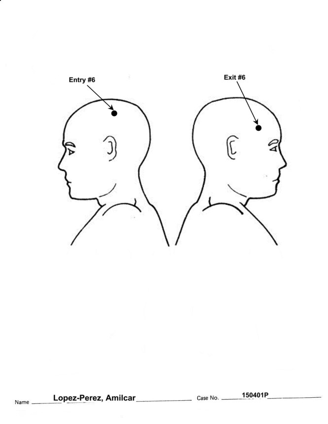 Head, Male—Lateral